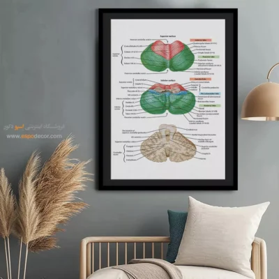 تابلو آناتومی - اسپو دکور