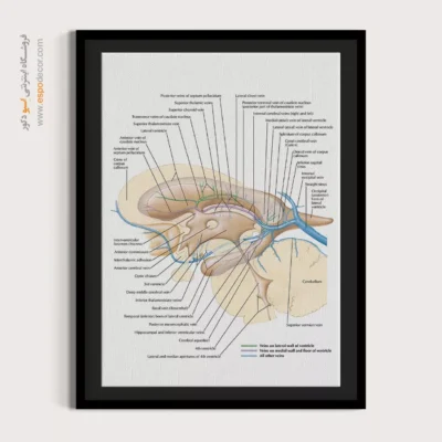 تابلو آناتومی - اسپو دکور