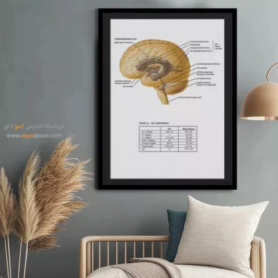 تابلو آناتومی - اسپو دکور