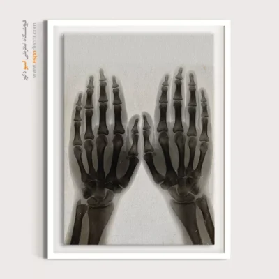 تابلو آناتومی - اسپو دکور