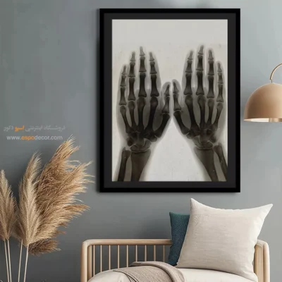 تابلو آناتومی - اسپو دکور