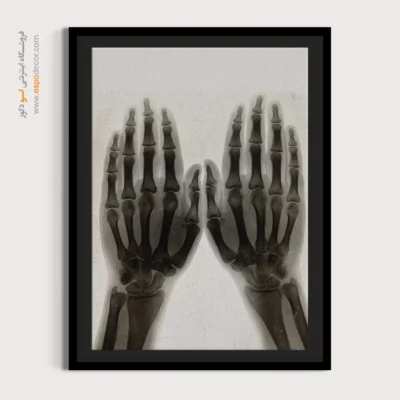 تابلو آناتومی - اسپو دکور