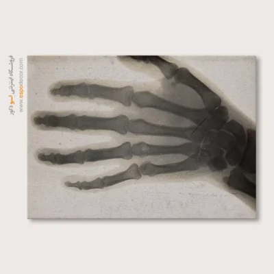 تابلو آناتومی - اسپو دکور