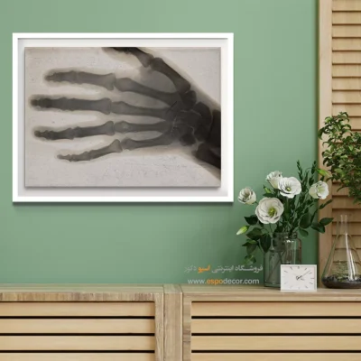 تابلو آناتومی - اسپو دکور