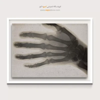 تابلو آناتومی - اسپو دکور