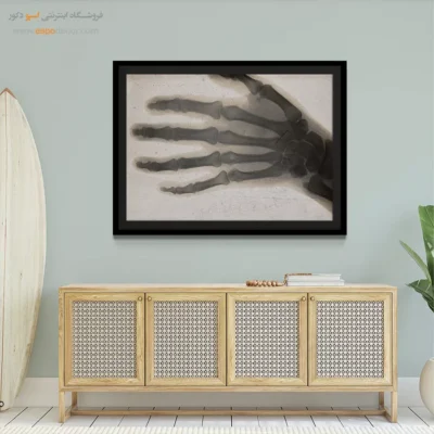 تابلو آناتومی - اسپو دکور