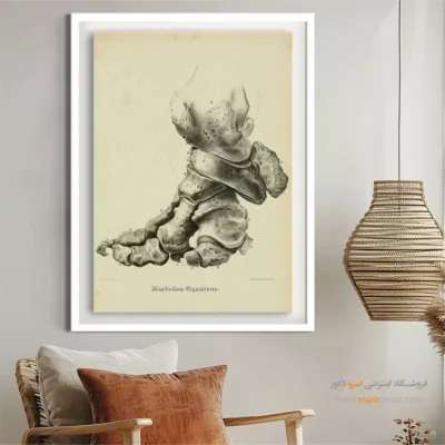 تابلو اسکلت - اسپو دکور