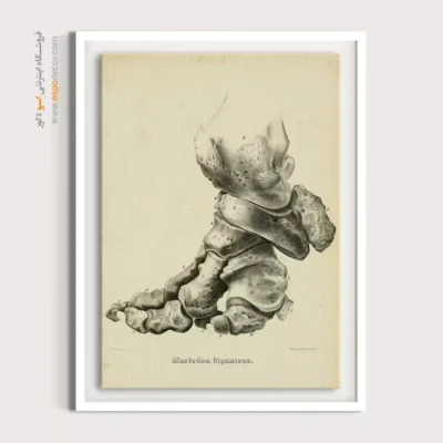 تابلو اسکلت - اسپو دکور