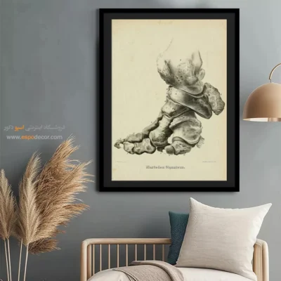 تابلو اسکلت - اسپو دکور