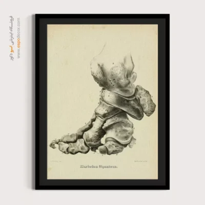 تابلو اسکلت - اسپو دکور