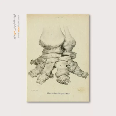 تابلو اسکلت - اسپو دکور