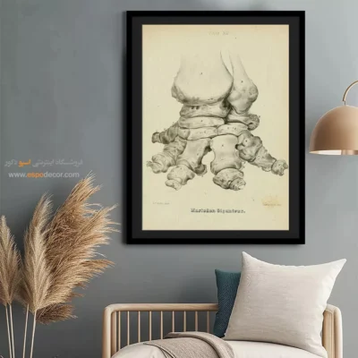 تابلو اسکلت - اسپو دکور