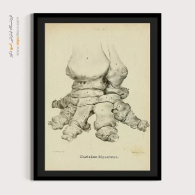 تابلو اسکلت - اسپو دکور